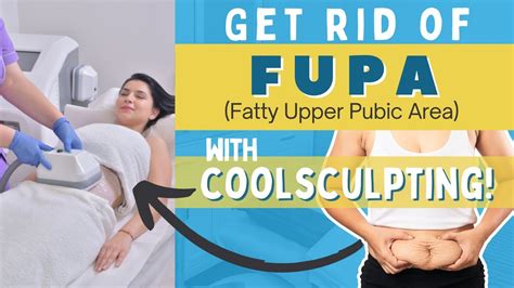 fat puss|FUPA: Fatty Upper Pubic Areas .